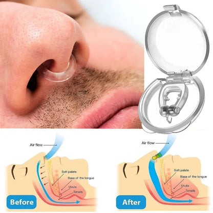 Anti snoring corrector